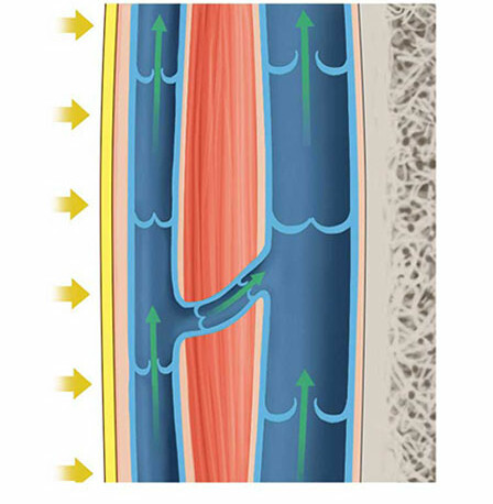 Com meia de compressão: veia funcionando