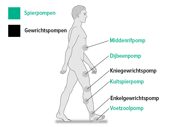 Spier- en gewrichtspompen Spier- en gewrichtspompen