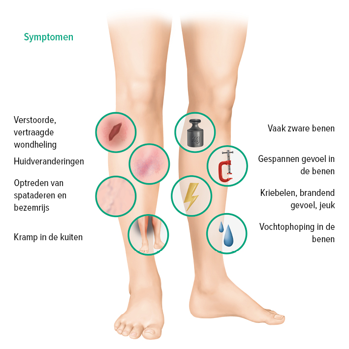 Symptomen bij een CVI Symptomen bij een CVI