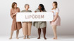Vier Frauen halten ein Schild mit der Aufschrift Lipödem hoch und lächeln