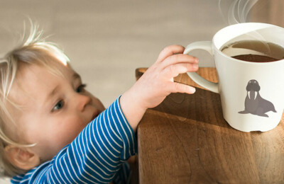Tag des brandverletzten Kindes: Tee tut weh!